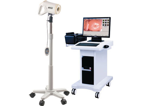 Digital Colposcope with Software