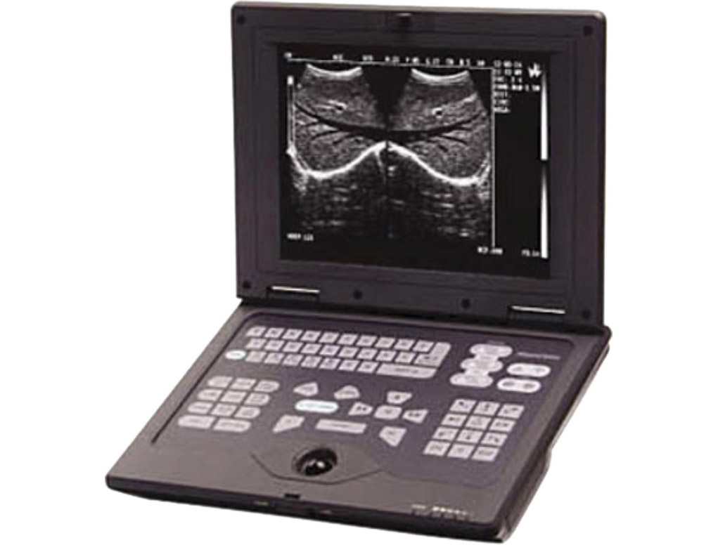 SMARTBOOK ULTRASOUND SCANNER