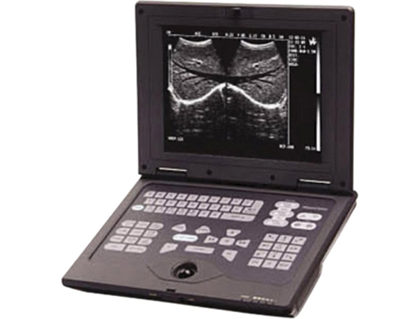 SMARTBOOK ULTRASOUND SCANNER